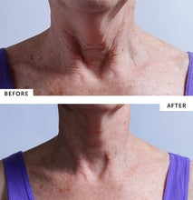 Load image into Gallery viewer, Silc Skin Collette Pad for Neck Wrinkles