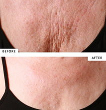 Load image into Gallery viewer, Silc Skin Decollette Pad for Chest Wrinkles