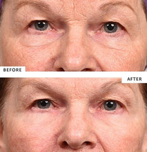 Load image into Gallery viewer, Silc Skin Eye Pads for Wrinkles